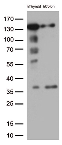 CDH1 Monoclonal Antibody (OTI1F3), TrueMAB , OriGene 100 &mu;L; Unconjugated:Antibodies,