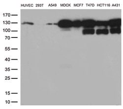 CDH1 Monoclonal Antibody (OTI2F9), TrueMAB , OriGene 100 &mu;L; Unconjugated:Antibodies,