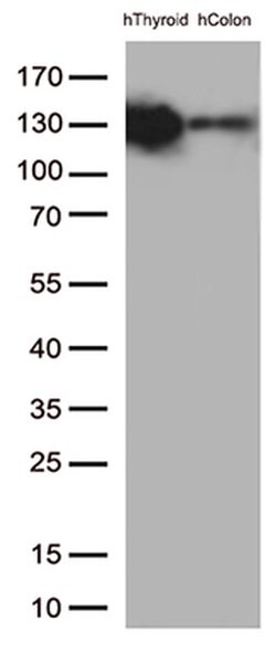 CDH1 Monoclonal Antibody (OTI2F9), TrueMAB , OriGene 100 &mu;L; Unconjugated:Antibodies,