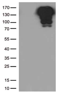 CDH1 Mouse anti-Human, Clone: OTI4F1, lyophilized, TrueMAB 100 &mu;g; Unconjugated:Antibodies,