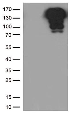 CDH1 Monoclonal Antibody (OTI4F1), TrueMAB , OriGene 100 &mu;L; Unconjugated:Antibodies,