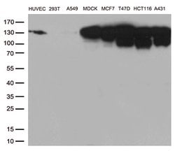 CDH1 Mouse anti-Human, Clone: OTI4F1, lyophilized, TrueMAB 100 &mu;g; Unconjugated:Antibodies,
