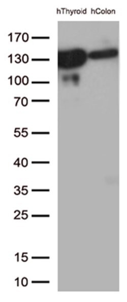 CDH1 Mouse anti-Human, Clone: OTI4F1, lyophilized, TrueMAB 100 &mu;g; Unconjugated:Antibodies,