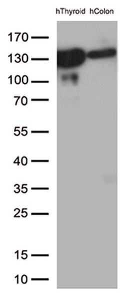 CDH1 Monoclonal Antibody (OTI4F1), TrueMAB , OriGene 100 &mu;L; Unconjugated:Antibodies,