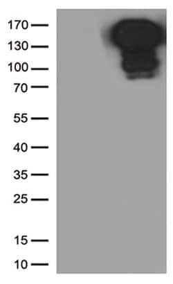CDH1 Monoclonal Antibody (OTI1G1), TrueMAB , OriGene 100 &mu;L; Unconjugated:Antibodies,