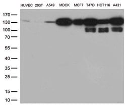 CDH1 Monoclonal Antibody (OTI1G1), TrueMAB , OriGene 100 &mu;L; Unconjugated:Antibodies,