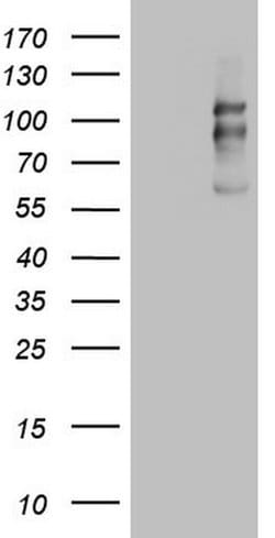 CDH1 Monoclonal Antibody (OTI3C11), TrueMAB , OriGene 100 &mu;L; Unconjugated:Antibodies,