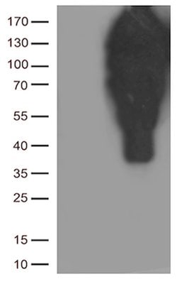 CDH1 Mouse anti-Human, Clone: UMAB184, lyophilized, UltraMAB 100 &mu;g;