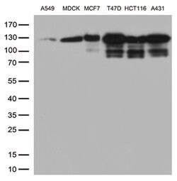 CDH1 Mouse anti-Human, Clone: UMAB184, lyophilized, UltraMAB 100 &mu;g;