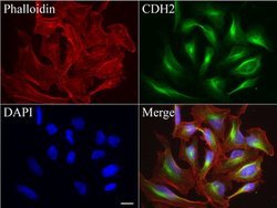 CDH2 Mouse anti-Human, Clone: UMAB23, lyophilized, UltraMAB 100 &mu;g;