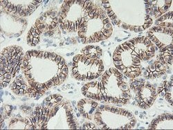 CDH2 Mouse anti-Canine, Human, Mouse, Clone: OTI2G7, lyophilized, TrueMAB