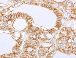 CDH2 Mouse anti-Human, Clone: UMAB23, lyophilized, UltraMAB 100 &mu;g;