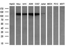 CDH2 Monoclonal Antibody (OTI3B10), TrueMAB , OriGene 100 &mu;L; Unconjugated:Antibodies,