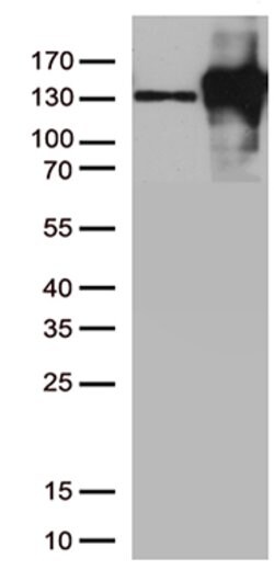 CDH2 Mouse anti-Canine, Human, Mouse, Clone: OTI2G7, lyophilized, TrueMAB