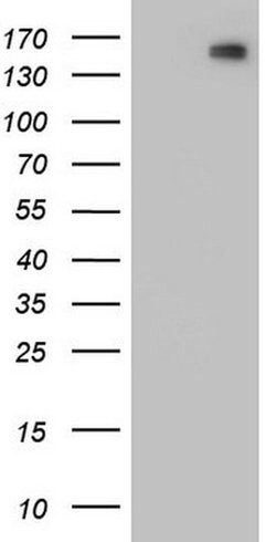 CDH2 Monoclonal Antibody (OTI1C5), TrueMAB , OriGene:Antibodies:Primary