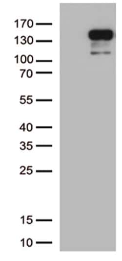 CDH2 Mouse anti-Human, Clone: OTI5F8, lyophilized, TrueMAB 100 &mu;g; Unconjugated:Antibodies,