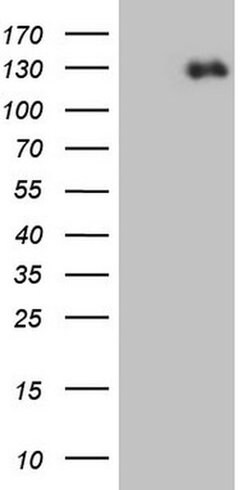 CDH2 Monoclonal Antibody (OTI6E5), TrueMAB , OriGene 100 &mu;L; Unconjugated:Antibodies,