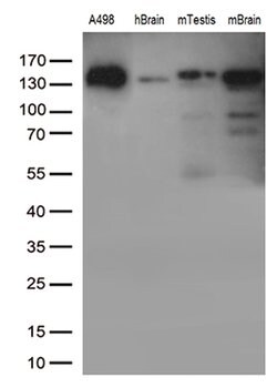 CDH2 Mouse anti-Human, Clone: UMAB23, lyophilized, UltraMAB 100 &mu;g;