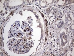CDH4 Monoclonal Antibody (OTI6H5), TrueMAB , OriGene 100 &mu;L; Unconjugated:Antibodies,