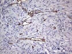 CDH4 Monoclonal Antibody (OTI6H5), TrueMAB , OriGene 100 &mu;L; Unconjugated:Antibodies,