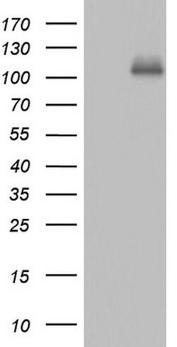 CDH4 Mouse anti-Human, Clone: OTI4F5, lyophilized, TrueMAB 100 &mu;g; Unconjugated:Antibodies,