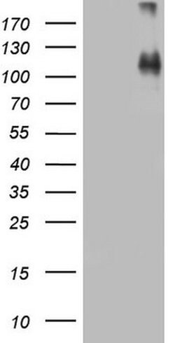 CDH4 Mouse anti-Human, Clone: OTI1B7, lyophilized, TrueMAB 100 &mu;g; Unconjugated:Antibodies,