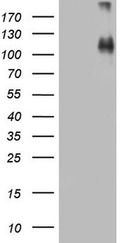 CDH4 Monoclonal Antibody (OTI1B7), TrueMAB , OriGene 30 &mu;L | Buy Online | Origene Technologies | Fisher Scientific