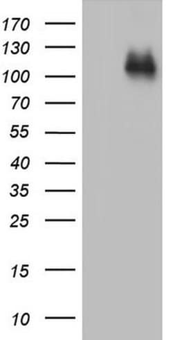 CDH4 Monoclonal Antibody (OTI6H5), TrueMAB , OriGene 100 &mu;L; Unconjugated:Antibodies,