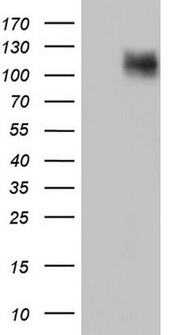 CDH4 Monoclonal Antibody (OTI4D9), TrueMAB , OriGene:Antibodies:Primary