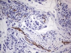 CDH5 Monoclonal Antibody (OTI1F4), TrueMAB , OriGene 100 &mu;L; Unconjugated:Antibodies,