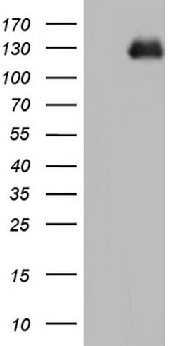 CDH5 Monoclonal Antibody (OTI1F4), TrueMAB , OriGene 100 &mu;L; Unconjugated:Antibodies,