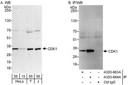 CDK1 Rabbit anti-Human, Polyclonal, Bethyl Laboratories 100 &mu;L; Unconjugated:Antibodies,