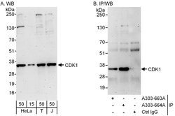CDK1 Rabbit anti-Human, Polyclonal, Bethyl Laboratories 100 &mu;L; Unconjugated:Antibodies,