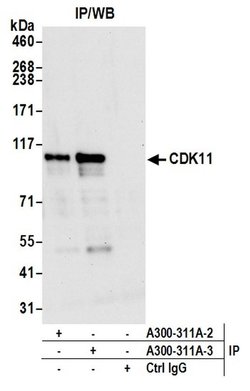 CDK11 Rabbit anti-Human, Polyclonal, Bethyl Laboratories 100 &mu;L; Unconjugated:Antibodies,