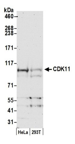 CDK11 Rabbit anti-Human, Polyclonal, Bethyl Laboratories 100 &mu;L; Unconjugated:Antibodies,