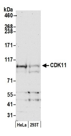 CDK11 Polyclonal Antibody, Bethyl Laboratories 20 &mu;L; Unconjugated:Antibodies,