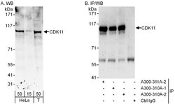 CDK11 Rabbit anti-Human, Polyclonal, Bethyl Laboratories 100 &mu;L; Unconjugated:Antibodies,