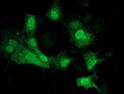 CDK2 Mouse anti-Human, Clone: OTI2F10, lyophilized, TrueMAB 100 &mu;g;