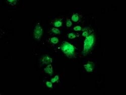 CDK2 Monoclonal Antibody (OTI1H5), TrueMAB , OriGene 100 &mu;L; Unconjugated:Antibodies,