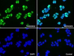 CDK2 Monoclonal Antibody (OTI1H5), TrueMAB , OriGene 100 &mu;L; Unconjugated:Antibodies,