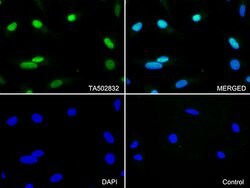 CDK2 Monoclonal Antibody (OTI1H5), TrueMAB , OriGene 100 &mu;L; Unconjugated:Antibodies,
