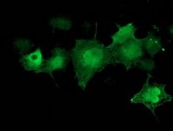 CDK2 Mouse anti-Human, Clone: OTI4B4, lyophilized, TrueMAB 100 &mu;g; Unconjugated:Antibodies,