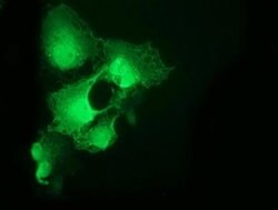 CDK2 Monoclonal Antibody (OTI6H2), TrueMAB , OriGene 100 &mu;L; Unconjugated:Antibodies,