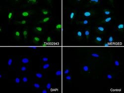 CDK2 Monoclonal Antibody (OTI1A8), TrueMAB , OriGene 30 &mu;L; Unconjugated:Antibodies,