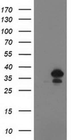 CDK2 Mouse anti-Human, Clone: OTI1C4, liquid, TrueMAB 100 &mu;L; Unconjugated:Antibodies,
