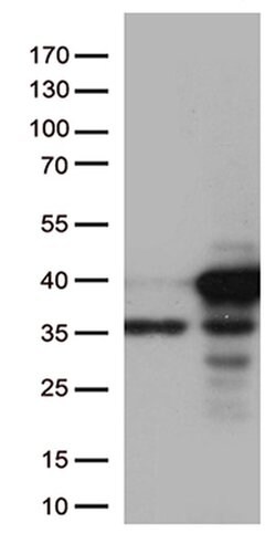 CDK2 Monoclonal Antibody (OTI1H5), TrueMAB , OriGene 100 &mu;L; Unconjugated:Antibodies,