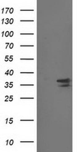 CDK2 Monoclonal Antibody (OTI4B4), TrueMAB , OriGene 100 &mu;L; Unconjugated:Antibodies,
