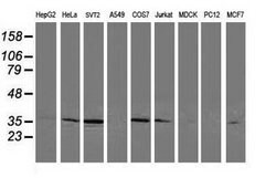 CDK2 Mouse anti-Human, Clone: OTI4B4, lyophilized, TrueMAB 100 &mu;g; Unconjugated:Antibodies,