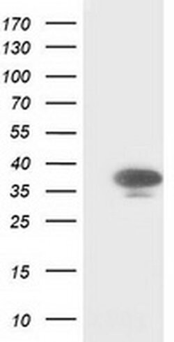 CDK2 Monoclonal Antibody (OTI4D3), TrueMAB , OriGene 100 &mu;L; Unconjugated:Antibodies,