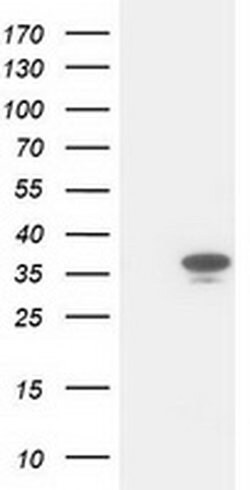 CDK2 Monoclonal Antibody (OTI6H2), TrueMAB , OriGene 100 &mu;L; Unconjugated:Antibodies,